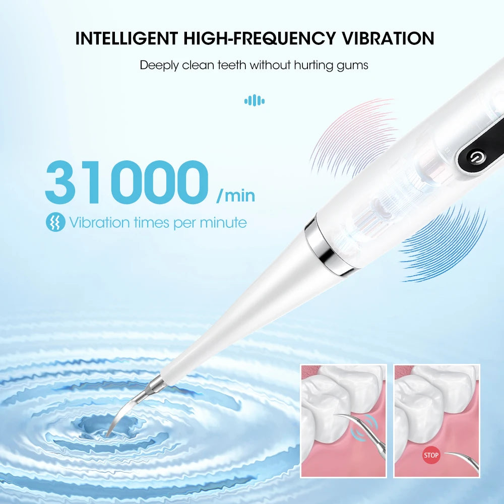 NoviaGlow Ultrasonic Tooth Cleaner – Plaque & Tartar Remover