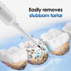 NoviaGlow Ultrasonic Tooth Cleaner – Plaque & Tartar Remover