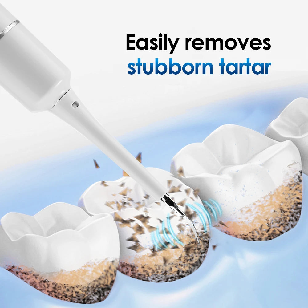 NoviaGlow Ultrasonic Tooth Cleaner – Plaque & Tartar Remover
