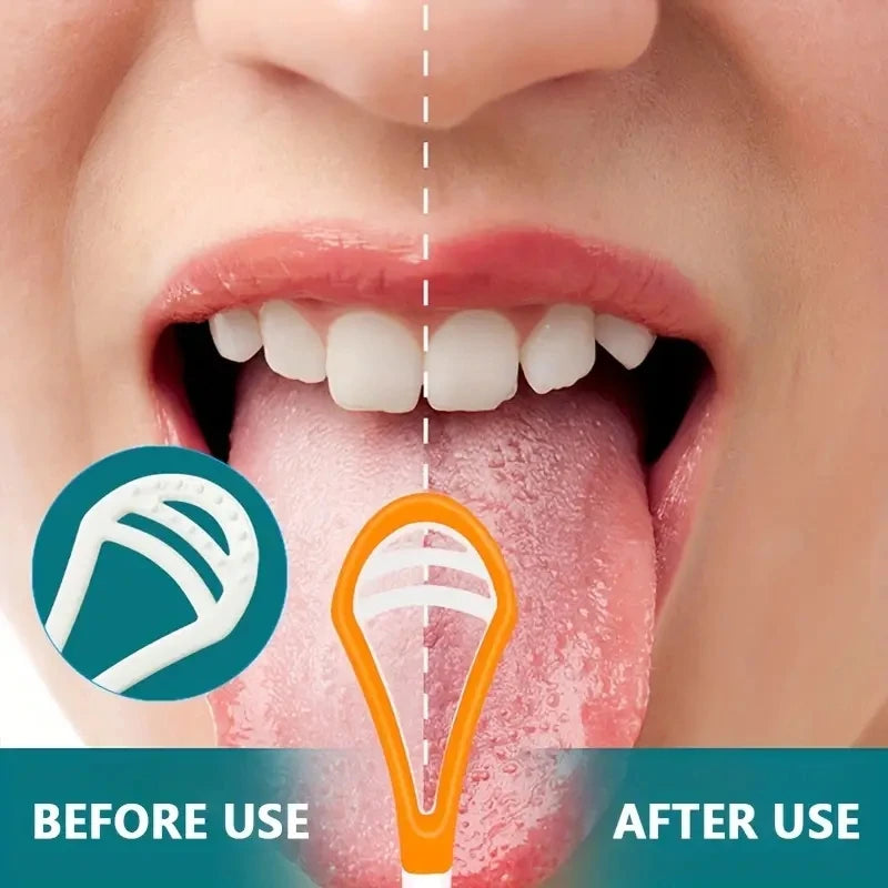 NoviaGlow Tongue Scraper Brush – Soft, Durable Oral Care Cleaner for Fresh Breath & Daily Hygiene