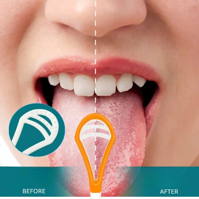 NoviaGlow Tongue Scraper Brush – Soft, Durable Oral Care Cleaner for Fresh Breath & Daily Hygiene