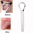 NoviaGlow Stainless Steel Tongue Cleaner