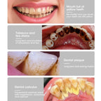 causes of yellow teeth