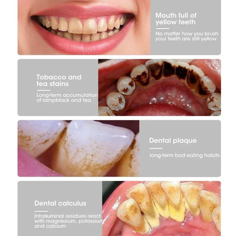 causes of yellow teeth