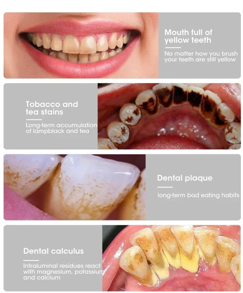 different causes of yellow teeth