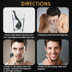 NoviaGlow Derma Roller